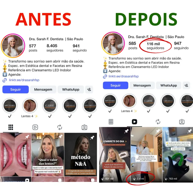 Antes e depois Dra. Sarah Fernandes